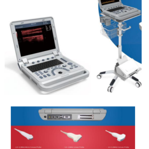 Ultrasound machine 15’inch colour 12Gig memory, LI Battery